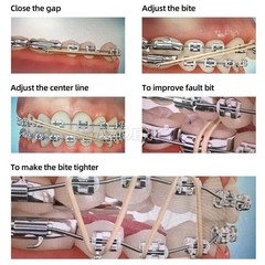 5000Pcs Dental Orthodontic Elastics Braces / Rectangular Anterior Tooth Torque
