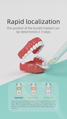 Dental Implant Detector Surgical Locator 360° Rotating Smart Finder Tool Sensor