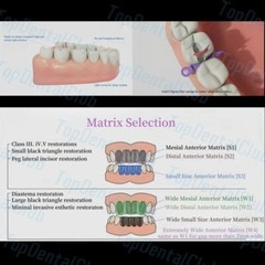 1Kit Dental Clear Matrix BT Bow Tranparent Matrices Fit BioClear Black Triangle