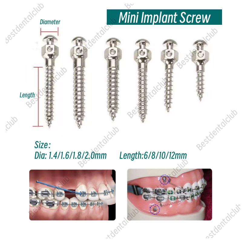 Dental Mini Screw Micro Implants Achor Screws Orthodontic Titanium Alloy
