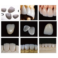 5Pcs/Box Dental C14 Glass Ceramic Lithium Dislicate Blocks Cerec CAD CAM