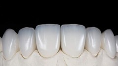 C14 Ceramic Blocks Lithium Disilicate Cerec CAD CAM HT/LT/MT A1 A2 A3 10Pcs/Box