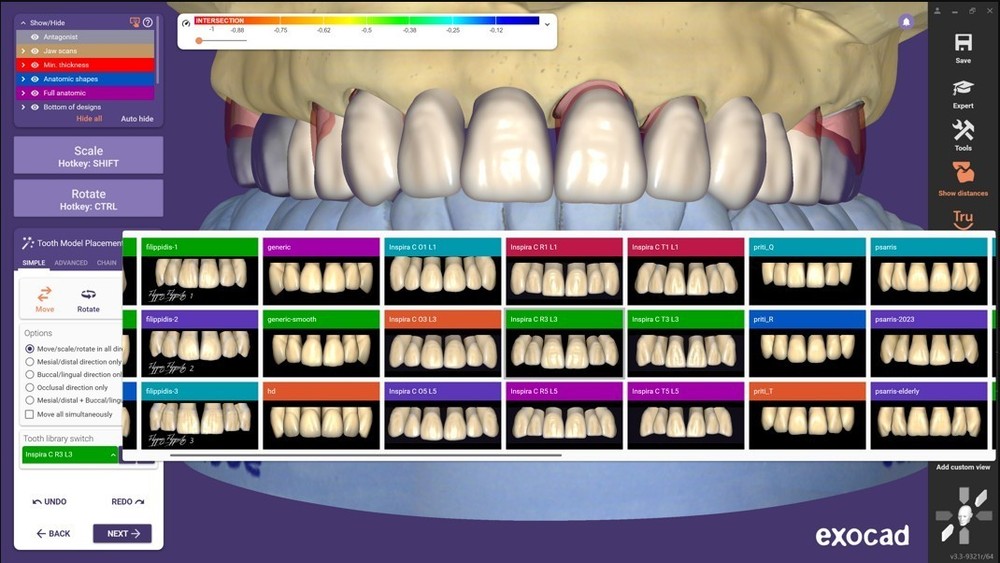 Exocad 3.3 Chemnitz – Dental CAD/CAM