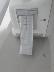 GE Dash 3000 Nellcor sp02 and soft 7.2 with 4 IBP and Co2 90 DAYS RETURN WARRA