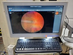 Zeiss Clarus 500 Ultra Wide Field Fundus Camera 200° UWF 2019