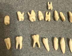 Vintage Dental Numbered 32 Anatomical Teeth Practice Identification Plastic