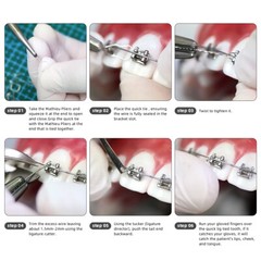 Dental Orthodontic Wires Kobayashi Preformed Ligature Ties Long/Short 100Pcs/Bag