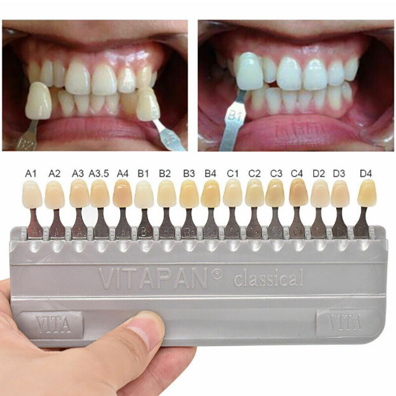 VITAPAN 16 Colour Tooth Shade Guide Classical First Copy Teeth Whiten Model
