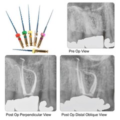 Dental NiTi Super Rotary Files Heat Activated for Endodontic Endo Motor 25mm USA