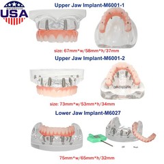 US Dental Overdenture/Implant/Orthodontic Typodont Ortho Training Teaching Model