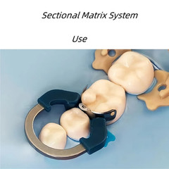 Dental Matrix Bands Clamp Ring Palodent V3 Sectional Matrix System Wedges Pliers