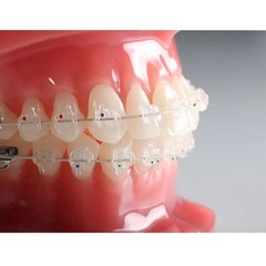 Koden Premium Plus MBT Ceramic Bracket Kits MBT 022 Free Shipping