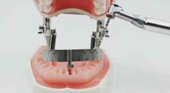 original julldent All on 4 Guide for multiple placement of implant FREE SHIPPING