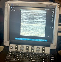 SonoSite M-Turbo Ultrasound System (2014) With 2 Transducer Probe & Rolling Car