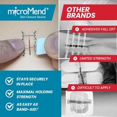 Micromend Emergency Wound Closure Kit Laceration To Butterfly 6 Sterile Wound