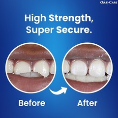 Zinc Oxide Eugenol Dental Cement for Instant Tooth & Crown Repair Kit