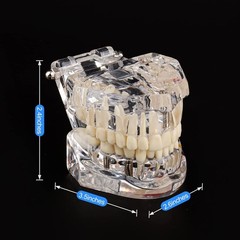 Dental Teaching Tool with Removable Teeth