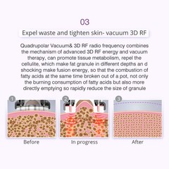9 in 1 Beauty Machine for Body Massage Facial Skin Care Skin Lifting Lost Weig3