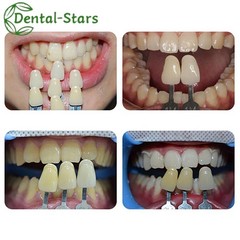 VITA Dental Shade Guide 16/29Colors Resin Material Toothguide Whitening Contrast