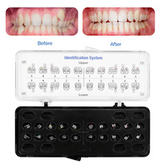 20pcs/Set Orthodontic Metal Brackets Braces Standard Roth/MBT 022/018 345 Hooks