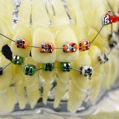 Dental Orthodonic Niti Round Arch Wire Super Elastic Ovoid Form 014 Upper/Lower