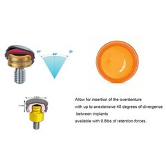 US Nobel Hiossen Zimmer titanium Overdenture Anchor Fit Zest Locator Abutment