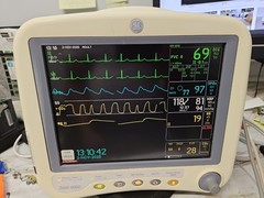 GE Dash 3000 sp02 and soft 7.2 , 4 IBP and Co2 Module , 90 Days Return