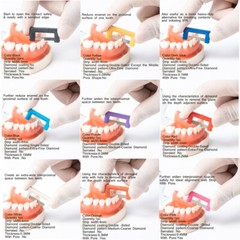 EASYINSMILE Orthodontic Dental IPR System Interproximal Peel Contra Angle Strips