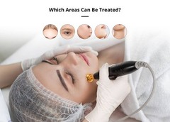Plasma Beauty Machine for Facial Glowing Skin Care Mole Spot Removal Home Spa