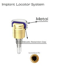 US Locator core tool fits zest locator abutment for HIOSSEN ET Fixture Regular