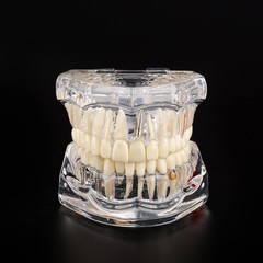 Dental Teaching Tool with Removable Teeth