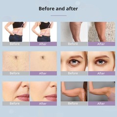 9 in 1 Beauty Machine Electric Body Massage Device Body Skin Care at Home Salon