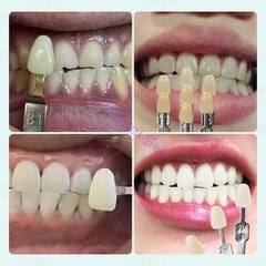 Dental VITA Toothguide 3D Master with Bleached Shade Guide Resin 29 Colors