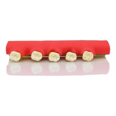 Dental Pathological Typodont Teeth Model Periodontics/Implant/Endodontic Caries