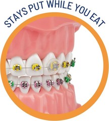 Orthodontic Wax Alternative Moisture Activated Clear Braces Wax 24 Hours