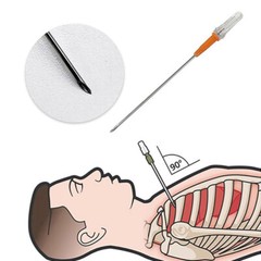 2pcs Rescue Tension Pneumothorax Needle Chest Decompression EDC First Aid 14G