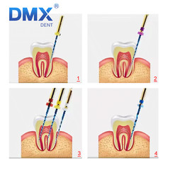 DMXDENT Dental Endo PT-Blue Root Canal Endodontic Niti Rotary Files 21/25/31MM