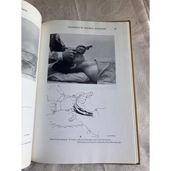 1976 Tracheal Intubation, Medical Book Applebaum, Vintage Anesthesiology