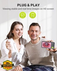 AnyScope Otoscope 1080P Camera 3.9mm Ear Scope