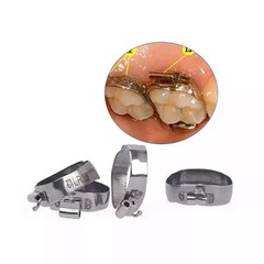 80Pcs Dental Orthodontic Bands with Buccal Tube 1st Molar MBT 022″ 16#-35#