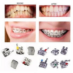 Dental Orthodontic Metal Bracket Braces Edgewise Roth/Mini/Standard 018/022 Slot