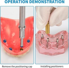 US Dental Locator Core Tool 3-in-1 Insertion Removal Driver Zest Locator Legacy