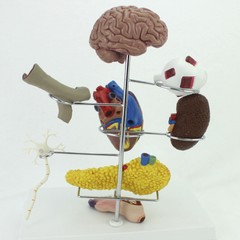 Medical Anatomical Human Diabetes Model 8 Parts Shows The Harm Of Diabetes