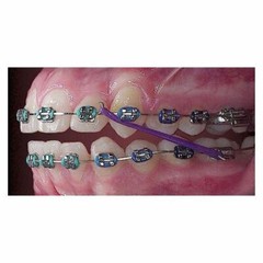 5x Dental Orthodontic Intraoral Latex Elastics Rubber Teeth Fox Ø1/4″
