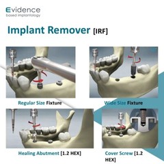 Evidence Implant Dental Implant Remover (IRF)