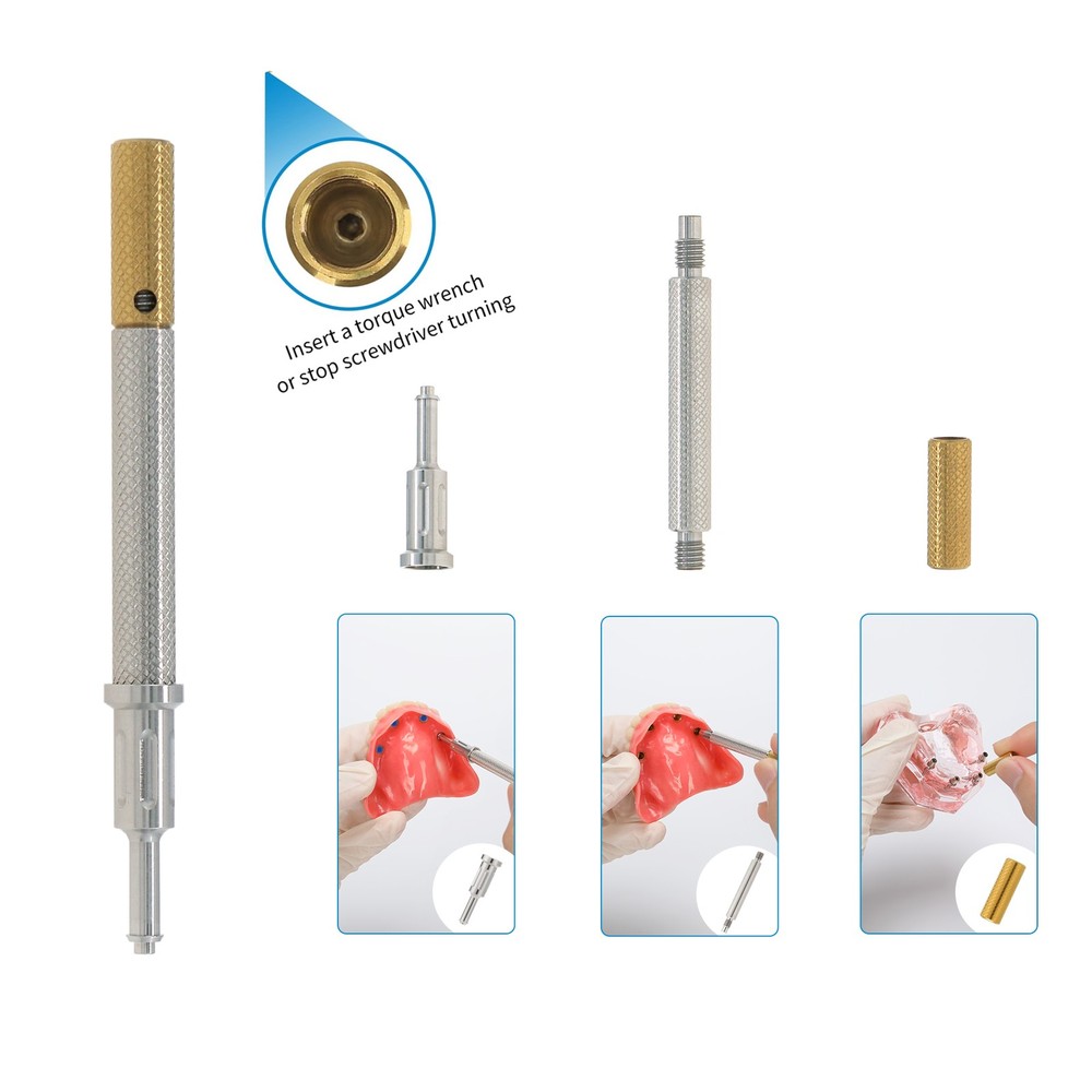 US Dental for Hiossen Mini Implant Locator Abutments & Overdenture Retention Cap