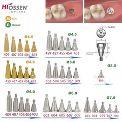 Dental Healing Abutment Cover Screw for ITI, Hiossen, Nobel, NC/RC, Regular/Mini