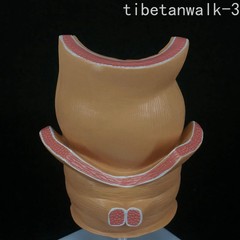Anatomical Human Rectum Pathology Lesion Model Hemorrhoids Anus Rectal