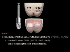 Lateral Window Sinus Elevation Drill Set, with elevator instrument set