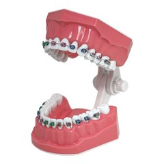 US Dental Typodont Ortho Teeth Model With Metal Braces for Brushing Practice